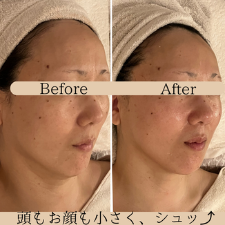 頭のむくみケア　ビフォーアフター