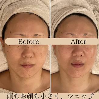 脳内洗浄　ビフォーアフター