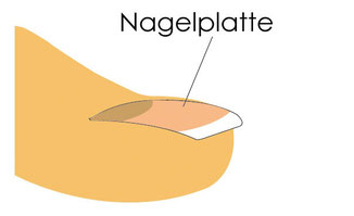 Nagelplatte