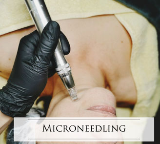Microneedling Behandlung in Rostock