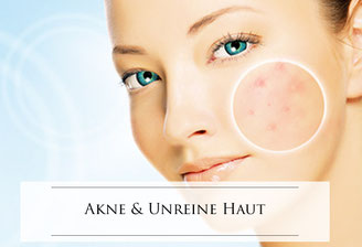 Akne Behandlung & Unreine Haut Behandlung in Rostock