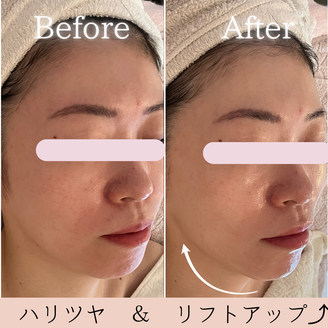 ハリツヤアップ&小顔ケア