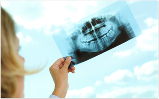Müssen die Weisheitszähne entfernt werden? Was empfehlen Zahnärzte? (© pressmaster - Fotolia.com)