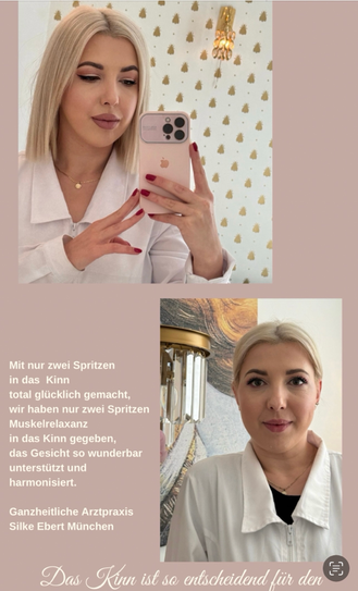 Botulinumtoxin München, Hängebäckchen, Falten