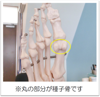 種子骨炎　松戸市　新松戸　ポプラはりきゅう整骨院