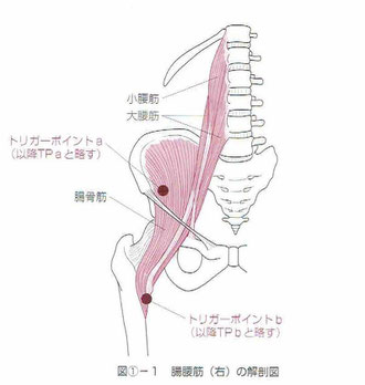 腸腰筋のトリガーポイント