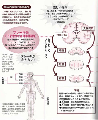 痛み感覚のアクセルとブレーキ