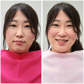 Befor After写真集 パーソナルカラー診断 Color Salon Amitie Befor After写真集 パーソナルカラー診断 Color Salon Amitie
