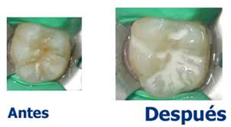 Odontopediatria Dentistas En Valle Dorado