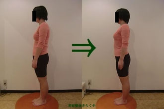 (結果には個人差があります。施術6回・期間2ヶ月)