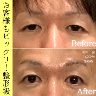 目のケア ビフォーアフター