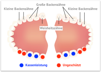 Was bezahlt die Kasse bei der Fissurenversiegelung? (© kyogo7002 - Fotolia.com)