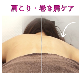 肩こり・巻き肩　ビフォーアフター