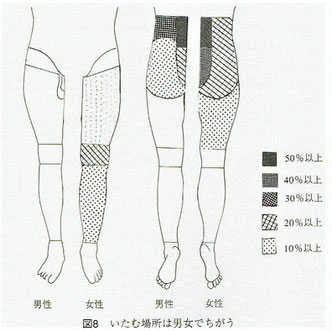 痛む場所は男女で違う