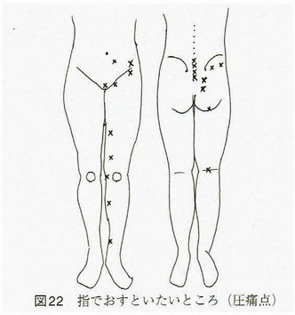 下肢の圧痛点