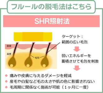 フルールの脱毛法:SHR照射法