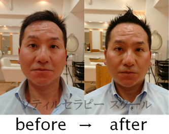 ソティルセラピー ケア後の結果