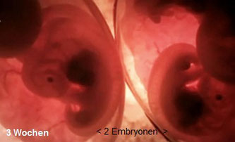 Bei den Embryonen  (Größe ca. 1 cm) beginnt nun die Anlage der Leber, Kiefer, Augen, Ohren und Nase