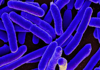 Das stäbchenförmige Escherichia coli-Bakterium kann schwere Infektionen verursachen (rasterelektronenmikroskopische Aufnahme). NIAID