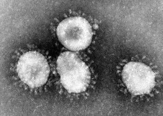 Coronavirus {} Content Providers(s): Wikipedia/CDC/Dr. Fred Murphy - Permission PD-USGov-HHS-CDC, Public domain