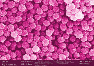 Zum Fürchten schön? Nanoplastik, elektronenmikroskopische Aufnahme, nachkoloriert, 150.000-fache Vergrösserung. Bild: Empa / ETH