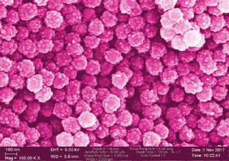 Zum Fürchten schön? Nanoplastik, elektronenmikroskopische Aufnahme, nachkoloriert, 150.000-fache Vergrösserung. Bild: Empa / ETH 