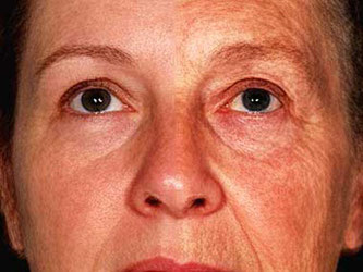 Eine Studie hat ergeben, dass das Vorhandensein eines Genes Gesichter älter oder jünger erscheinen lässt. Foto: Fan Liu