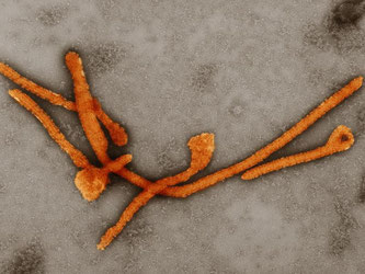 Elektronenmikroskopische Aufnahme von Ebolaviren: Das Virus kann sich mindestens neun Monate in der Samenflüssigkeit halten. Hans Gelderblom/RKI/Koloriert von Andrea Schnartendorff Foto: Hans R. Gelderblom/RKI