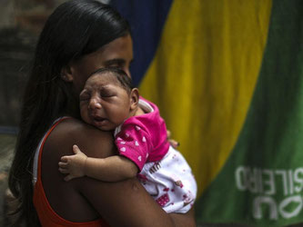 Mikrozephalie führt bei Säuglingen zu Schädelfehlbildungen. Forschern gelang der Nachweis dafür, dass Mikrozephalie durch das Zika-Virus ausgelöst wird. Foto: Antonio Lacerda/Archiv