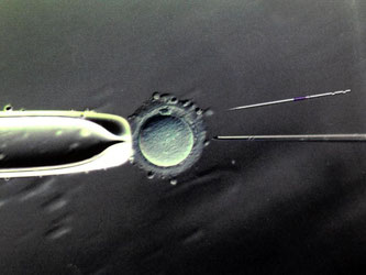 Befruchtung einer Eizelle mit einer Injektionspipette in 80- bis 100-facher Vergrößerung. Foto: Waltraud Grubitzsch
