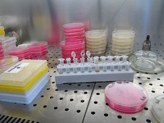 Petrischalen Labor Bakterien Untersuchung