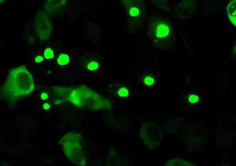 Das Bild zeigt humane Zellen, die fluoreszenz-markiertes mutiertes Huntingtin herstellen. Mutiertes Huntingtin neigt zur Anhäufung, die pathologisch ist und durch Punkte sichtbar wird. Copyright: Yasmin Richter