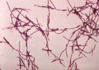 Bacillus anthracis ist ein bodenbürtiges Bakterium, das Milzbrand verursacht. William A. Clark/USCDCP