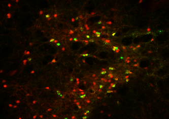 CRH-Neurone in der IPACL-Region produzieren ein rot fluoreszierendes Protein, das ihre Visualisierung erlaubt. Eine retrograde Markierung färbt CRH-Neurone zusätzlich grün, wenn sie mit der Substantia nigra im Mittelhirn verknüpft sind. Simon Chang MPI