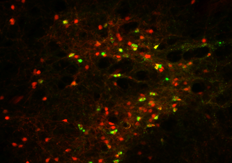 CRH-Neurone in der IPACL-Region produzieren ein rot fluoreszierendes Protein, das ihre Visualisierung erlaubt. Eine retrograde Markierung färbt CRH-Neurone zusätzlich grün, wenn sie mit der Substantia nigra im Mittelhirn verknüpft sind. Simon Chang MPI 