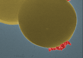 Die Magnet-Nanopartikel (rot) binden spezifisch an die rund 1 µm großen Bakterien (gelb) (Elektronenmikroskopie digital koloriert). Bild: Empa