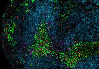 Ein Teil der Milz während einer chronischen Virusinfektion. Dendritische Zellen sind grün, Killer-T-Zellen rot, B-Zellen blau und Stromazellen magenta dargestellt. Team Wolfgang Kastenmüller Universität Würzburg
