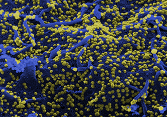 Vero6-Zellen infiziert mit SARS-CoV-2 © HZI / Mathias Müsken