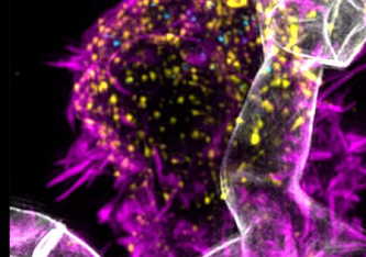 Pilz-CAR-T-Zell-Interaktion: in grau Aspergillus fumigatus, in Magenta CAR-T-Zellen, in Gelb die chimären Antigenrezeptoren, in hellblau bestimmte körpereigene Botenstoffe, welche die CAR-T-Zellen bei Interaktion mit dem Pilz produzieren und ausschütten.