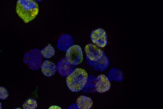 Blick ins Mikroskop: Man sieht menschliche Zellen in der Petrischale. Gelb gefärbt sind die acetylierten TDP-43-Proteinklümpchen, blau gefärbt ist die DNA in den Zellkernen. Jorge Garcia Morato Jorge Garcia Morato / HIH