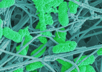 Wundkeime (Pseudomonas aeruginosa, hellgrün) zwischen Bindegewebsfasern von menschlicher Haut (blau-grau) (Rasterlektronenmikroskopie, koloriert). Bild: Empa