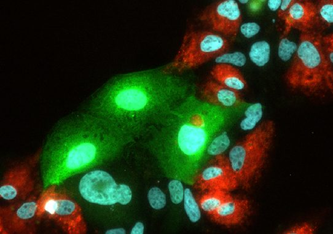 Replikation von Hepatitis C virus (HCV) und Heaptitis E Virus (HEV) in humanen Leberzellen. HCV leuchtet bei erfolgreicher Vermehrung rot, HEV grün. © Abteilung für Molekulare und Medizinische Virologie