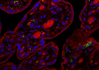 Schnitt durch eine mit SARS-CoV-2 infizierte menschliche Plazenta, die 24 Stunden nach der Infektion analysiert wurde. Das grüne Signal zeigt das Vorhandensein des viralen Proteins Spike und das blaue Signal die Zellkerne im Plazentagewebe an.