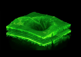 3D-Darstellung des mit einem OCT gewonnenen CScans der Netzhaut eines Patienten. Die OCT-Bildgebung wird von Augenärztinnen häufig zur Überwachung chronischer Augenerkrankungen wie altersbedingter Makuladegeneration (AMD), retinalem Venenverschluss (RVO)