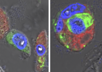 Mikroskopische Aufnahmen von Lungengewebe eines an COVID-19 Verstorbenen: Die Alveolarmakrophagen (rot, Zellkerne in blau) haben SARS-CoV-2-Virusmaterial (grün) aufgenommen (links). Die gestorbenen Zellen werden von den Makrophagen aufgenommen (rechts).