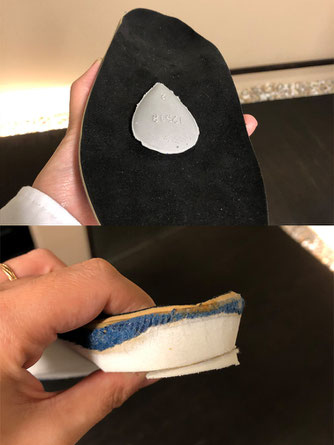 手直し例・<上>パッドを貼って横アーチを挙上させる <下>かかと裏に外側ウエッジを貼る