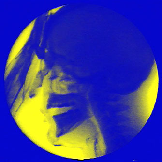 videokunst-progr-bern-sammlung-ketterer-gegenwartskunst-franticek-klossner-x-ray-video