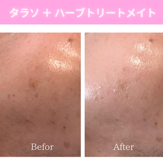 リアボーテ　ビフォーアフター