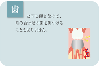 歯と同じ硬さなので、かみ合わせの歯を傷つけることもありません。