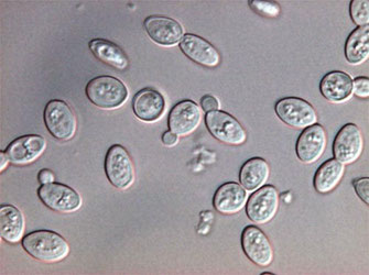 Levures observées au microscope optique. Sources: Didier Pol.